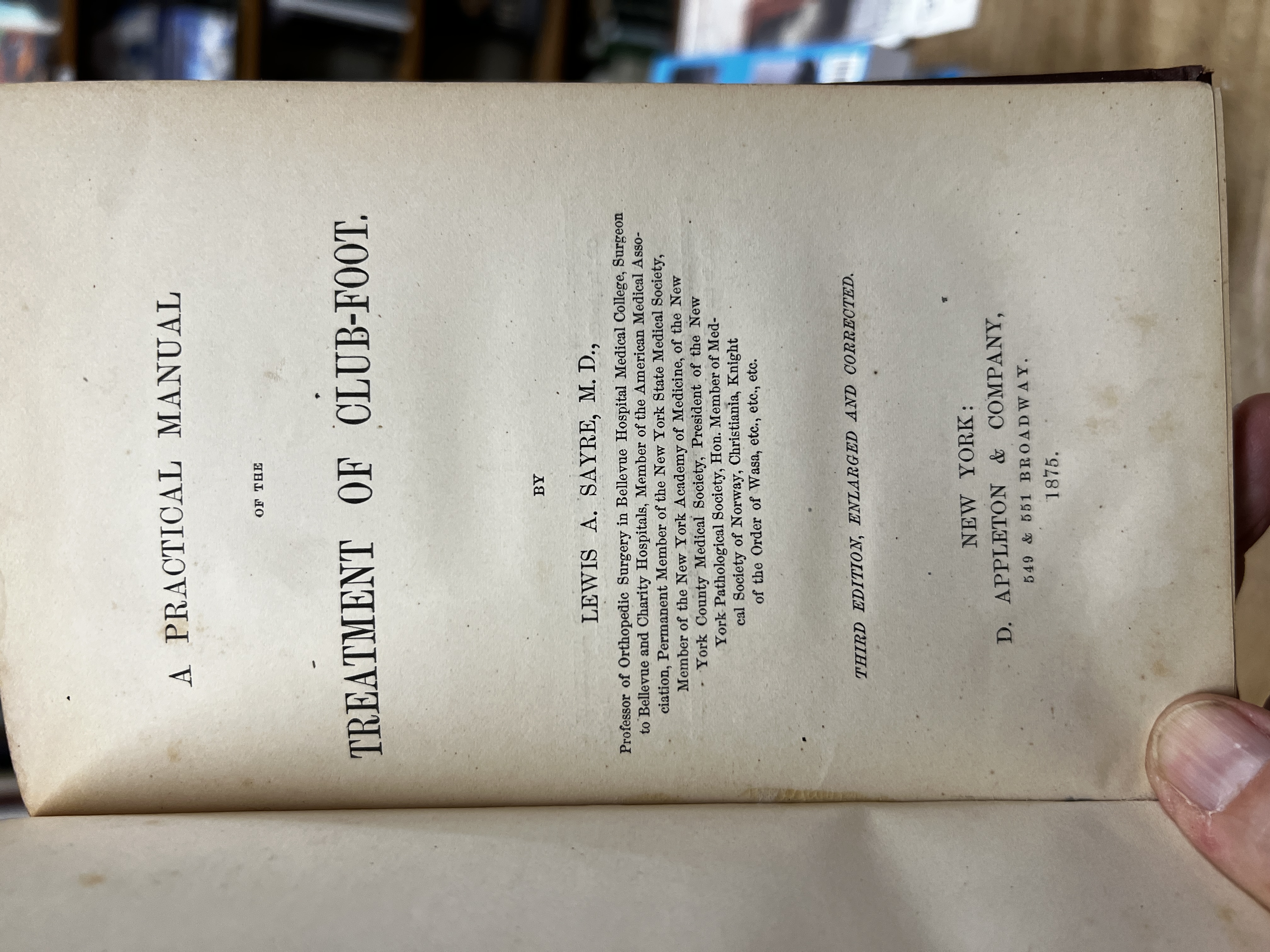 A Practical Manual of the Treatment of Club-Foot
